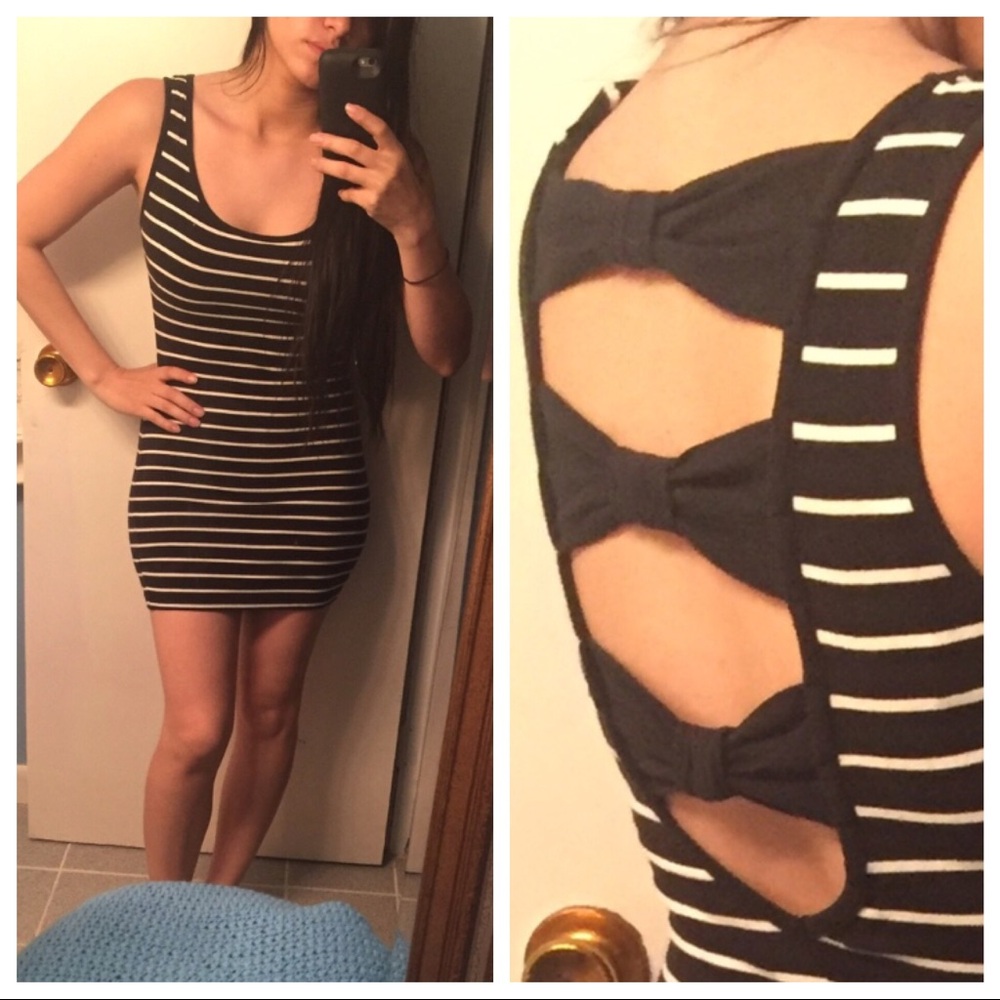 Forever 21 stripe dress with back detail